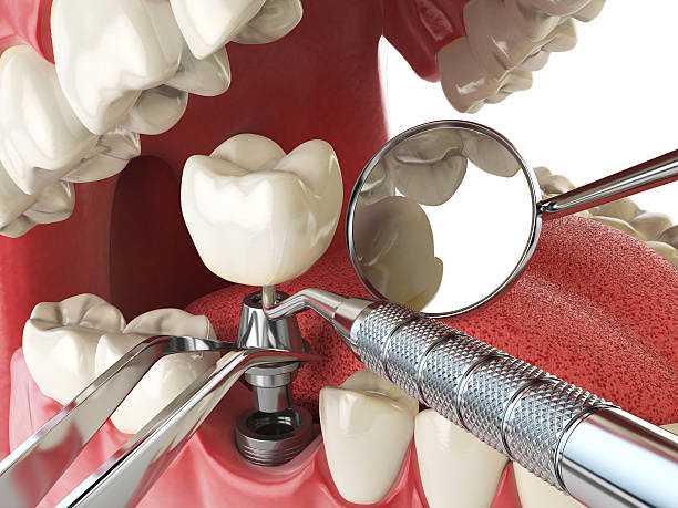 Best Cosmetic Emergency Dentistry in Lely Resort, FL
